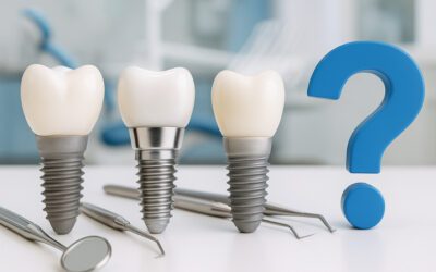 Які імпланти краще обрати для зубів?