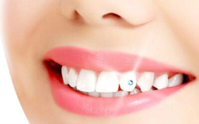 Що таке естетична стоматологія?